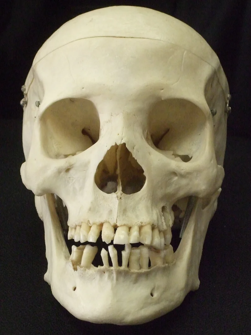 A source photograph of a pale skull against black.